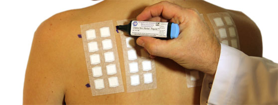 patient getting patch test